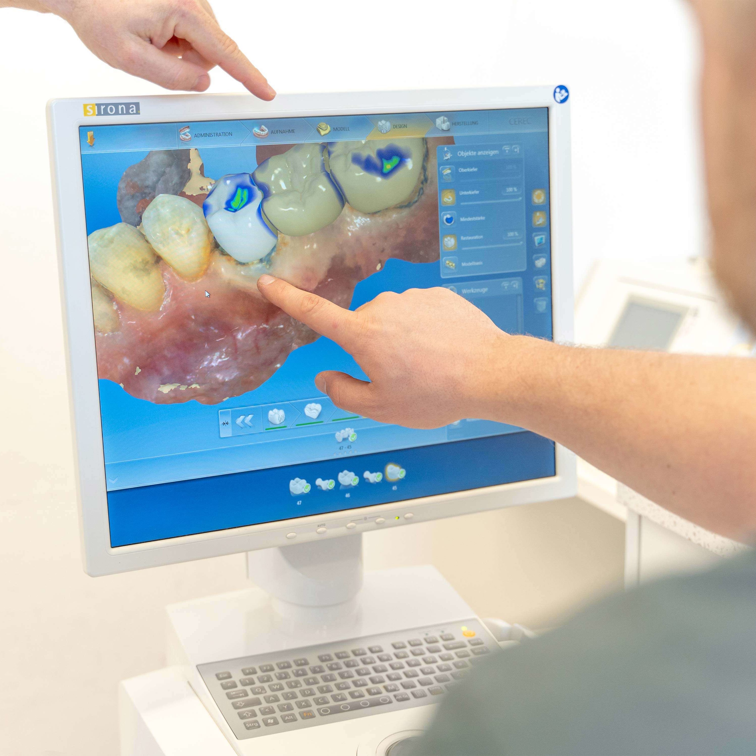 3D Zahnarzt Röntgen Zahnarzt Behandlung Rüsselsheim Zahnarztpraxis Dr. Dirk Dieudonné